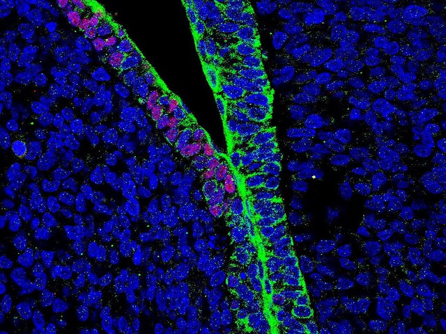 「ヒトとブタのキメラ」作製に成功、移植用臓器不足は解消するか