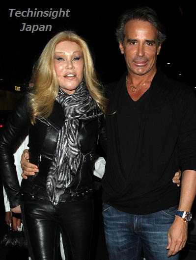 イタすぎるセレブ達 最も醜い整形顔 あのマダムが恋のおかげでキレイになっていた ライブドアニュース