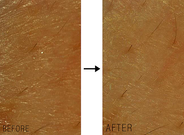 冬の毛穴トラブルを集中ケア ポアレスラボの冬季限定 スノートリートメント 体験プレゼント付 Peachy ライブドアニュース