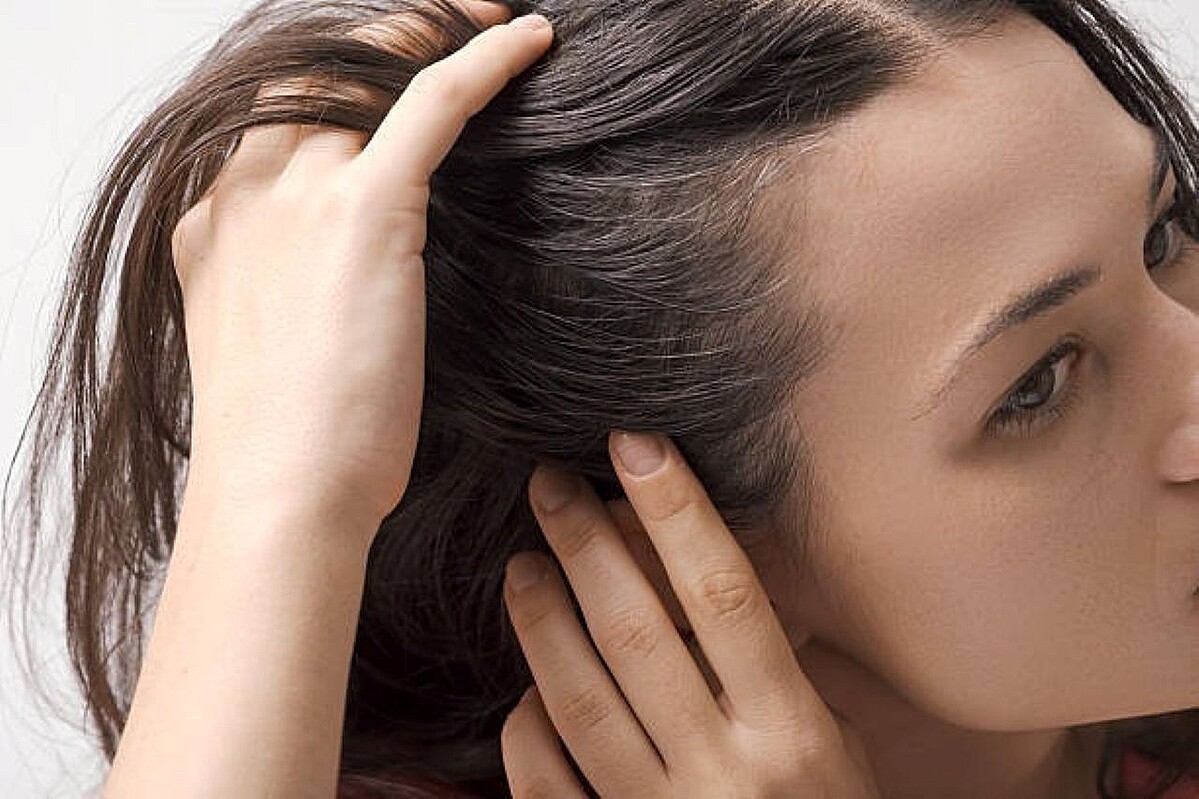 「髪の悩みに直結する」薄毛や抜け毛の大きな原因