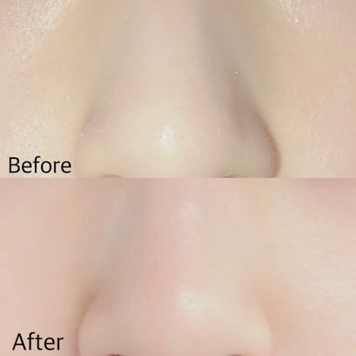 いちご鼻とは言わせない 簡単にツルスベ鼻になれちゃうアイテムを発見 Peachy ライブドアニュース