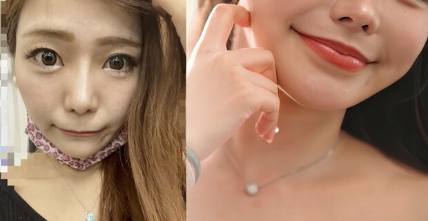 【写真・画像】26歳全身整形美女、“総額2000万円の整形”で「調子乗っちゃって」男性への目線の変化を明かす　1枚目