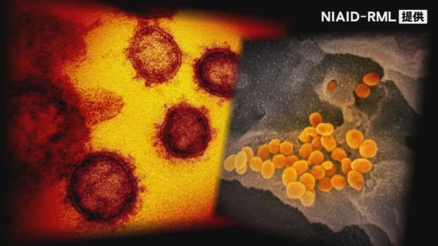 先月22日以来 金沢大学医学類学生が新型コロナウイルスに感染 ライブドアニュース