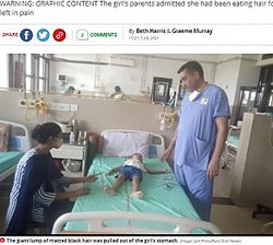 ±ǼŤ5нʲϡMirror2021ǯ75աDoctors remove huge hairball from five-year-old girls stomach - and it weighs over 3lbsסImage: Jam Press/Rare Shot Newsˡ٤Υ꡼󥷥åȡ