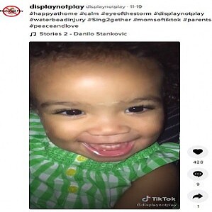 米の生後10カ月女児 無害 と表示されたウォータービーズで脳に障害 ライブドアニュース