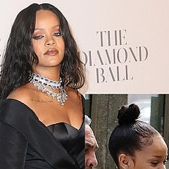 リアーナが薄毛に悩み始めている 髪を傷めてまでオシャレする女性セレブ ライブドアニュース リアーナが薄毛に悩み始めている 髪を傷めてまでオシャレする女性セレブ ライブドアニュース