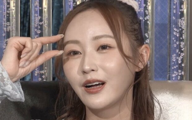 【写真・画像】「整形総額1000万円」てんちむ（32）、整形遍歴＆ダウンタイムを公開「トレンドに合わせて…」　1枚目