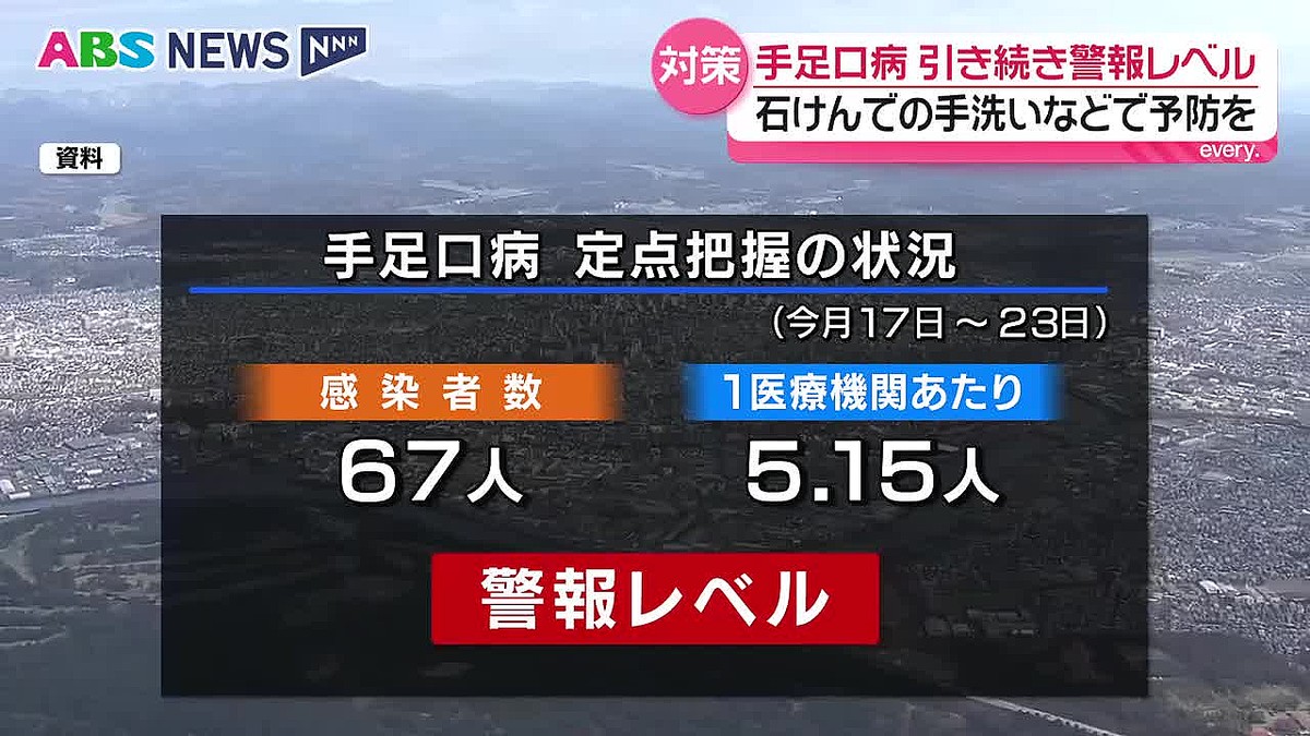 ABS秋田放送