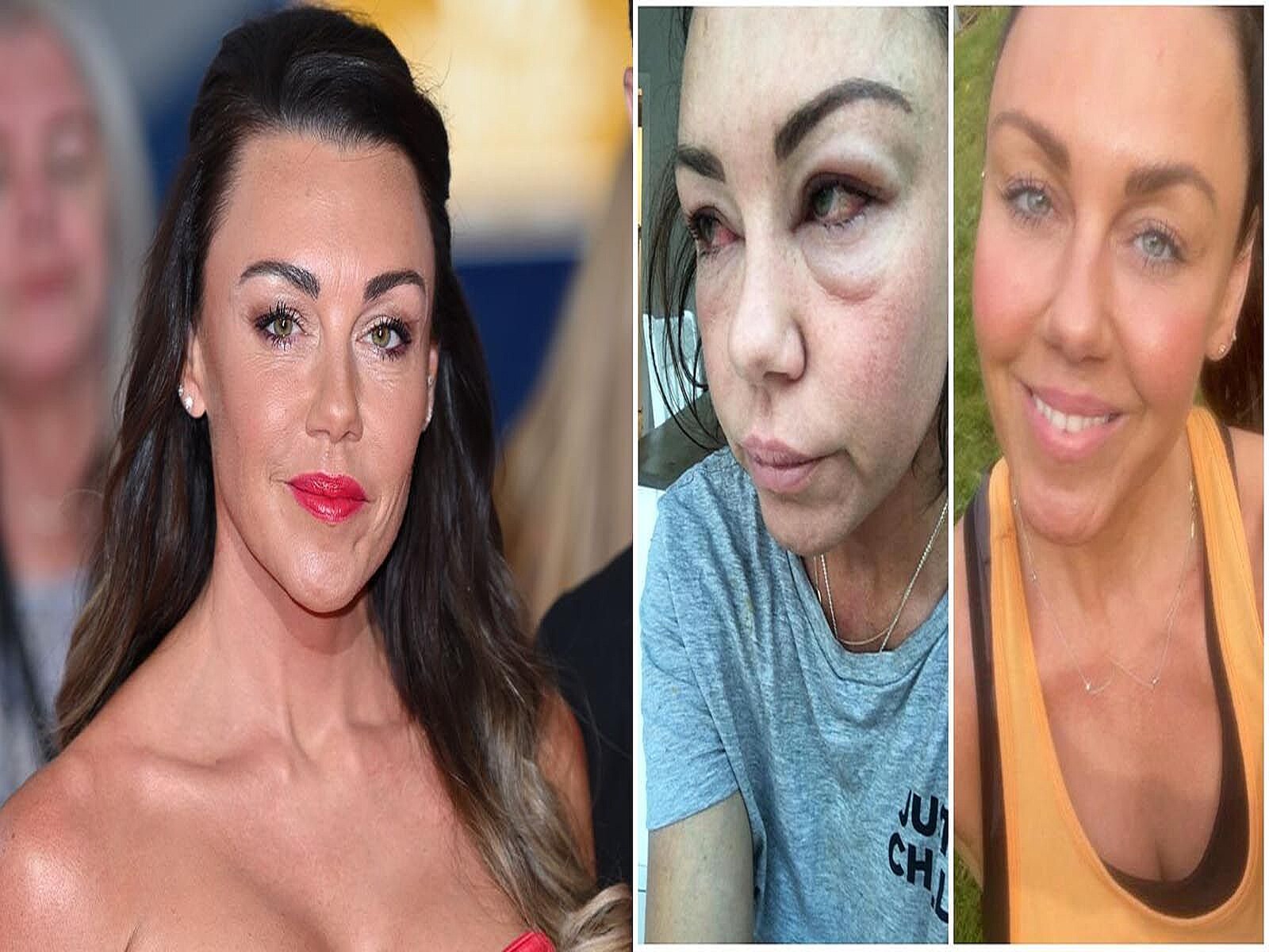 顔つきに変化が 歌手が明かす アルコール依存症 との闘い Peachy ライブドアニュース 顔つきに変化が 歌手が明かす アルコール依存症 との闘い Peachy ライブドアニュース