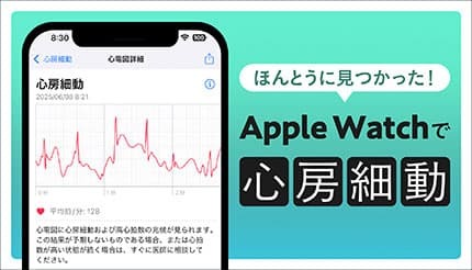 Apple Watchで見つかった「心房細動」