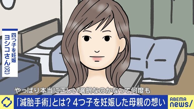 4つ子を妊娠で“減胎手術”