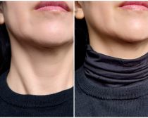 「首が老ける人」が無意識にやっていること「紫外線ケアは顔のみ」など