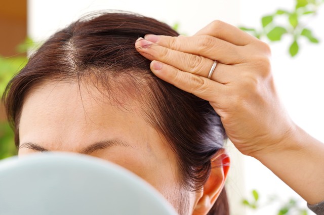 知らない他人の薄毛が気になったことはありますか？　※画像はイメージです（琢也 栂/stock.adobe.com）