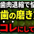 歯茎下がりを助長するブラシ指摘