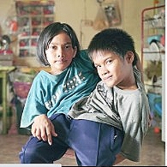 一生分離はしない タイ結合双生児の決断 前向きな姿勢に声援 ライブドアニュース 一生分離はしない タイ結合双生児の決断 前向きな姿勢に声援 ライブドアニュース