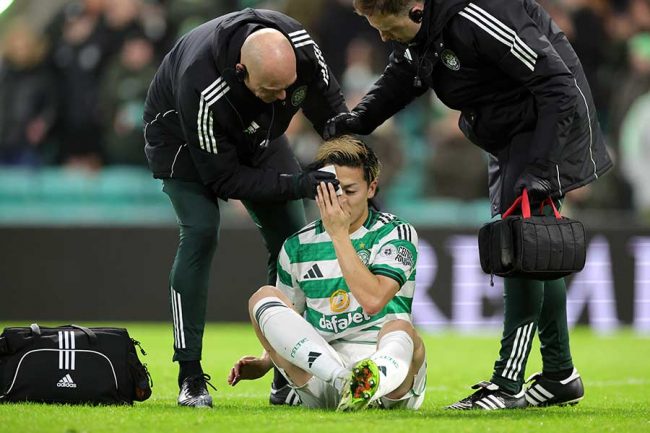 相手と競り合い、頭部付近を負傷したセルティックの前田大然（中央）【写真：PA Images/アフロ】