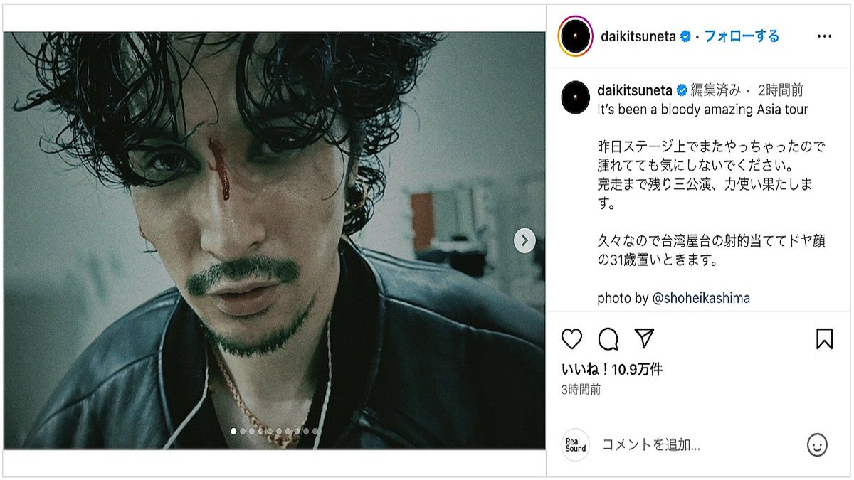 King Gnu 常田大希、眉間から流血 井口理はアジアツアーの仲睦まじい