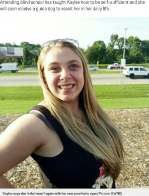 ���������ơ��д�򸫤�������ʲ����ϡ�Metro��2020ǯ8��9���ա�Woman who gouged out her eyes on drugs has prosthetic eyeballs fitted�ס�Picture: SWNS�ˡ٤Υ����꡼�󥷥�åȡ�