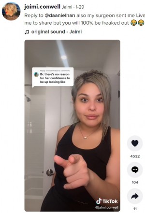 �������åȤ����ä����ǵ���ʼ��礬���Ĥ��ä������ʲ����ϡ�Jaimi��2022ǯ1��29����TikTok��Reply to ��daanielhan also my surgeon sent me Live Photos if you want me to share but you will 100�� be freaked out�ס٤Υ����꡼�󥷥�åȡ�