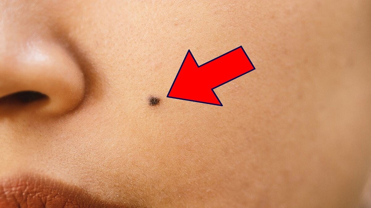 ⭐︎ ほくろ ⭐︎ ほくろ