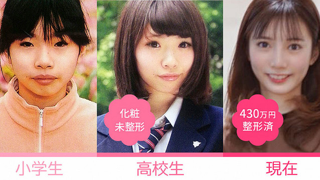 食べログの美容クリニック版 Meily って 美容整形アプリを作った川井優恵乃さん 後編 Peachy ライブドアニュース