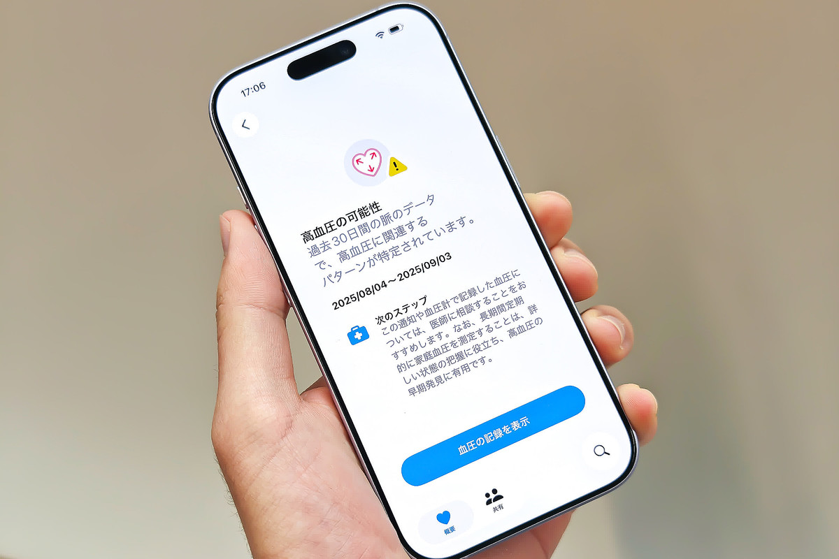 Apple Watch 高血圧の通知開始