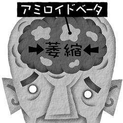 認知症の治療効果向上には自主性や周囲の協力が不可欠 進行を遅らせることは可能 ライブドアニュース