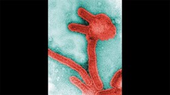 “致死率88%”の感染症が拡大 「マールブルグ病」日本は大丈夫?