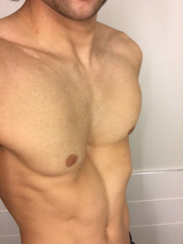 病気を克服したアメリカ人メダリスト 約束通りメダルをうpするぜ サイズ比較用にバナナも用意した ライブドアニュース