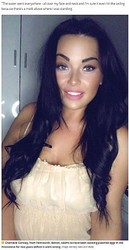 「電子レンジでポーチドエッグを作らないで」注意喚起した女性（画像は『Manchester Evening News　2021年7月15日付「‘Traumatised’ mum vows never to eat an egg again after microwave poaching hack leaves her with burns」（Image: Kennedy News and Media）』のスクリーンショット）