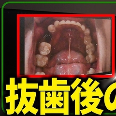 ���ʰ夬�����ȴ�������������Ϥʤ����ᡩ ���μ���򺸱����륻��ե�����������