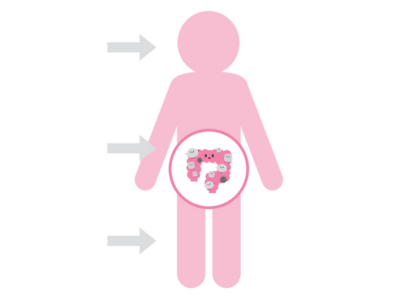 善玉菌を増やして痩せる！ 腸内バランスを整えるにはどの食品を選ぶべき？【新脂肪肝 代謝復活ダイエット】