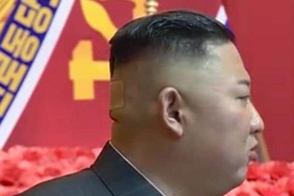 7月24日から27日にかけて行われた「朝鮮人民軍第1回指揮官・政治活動家講習会」で、金正恩総書記は絆創膏姿で登壇した（写真は朝鮮中央テレビから）