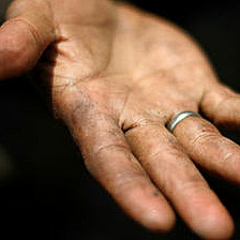 スウェーデンは体内のチップ埋め込みに肯定的か 背景には信頼も ライブドアニュース