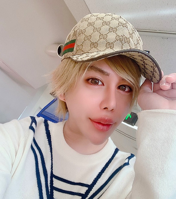 整形 男子 アレン ブログ