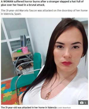 被害に遭う前、黒髪が美しい31歳女性(画像は『The Sun 2020年7月30日付「RANDOM ATTACK Woman suffers horror burns after stranger slaps glue-filled hat on her head in brutal doorstep attack」(Credit: Newsflash)』のスクリーンショット)