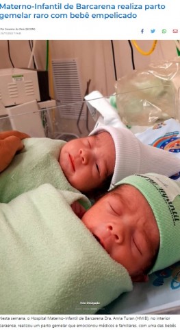 11月22日に誕生した双子姉妹(画像は『Agência Pará de Notícias 2022年11月25日付「Materno-Infantil de Barcarena realiza parto gemelar raro com bebê empelicado」(Foto: Divulgação)』のスクリーンショット)